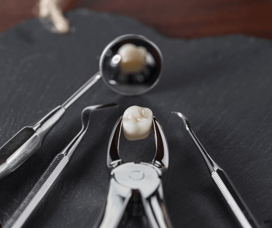 Tooth Extractions