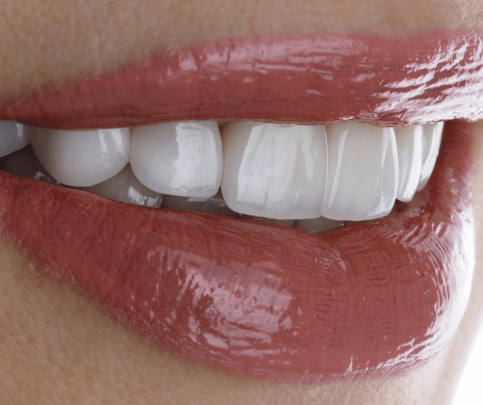 Zirconium Crowns/Full Veneers